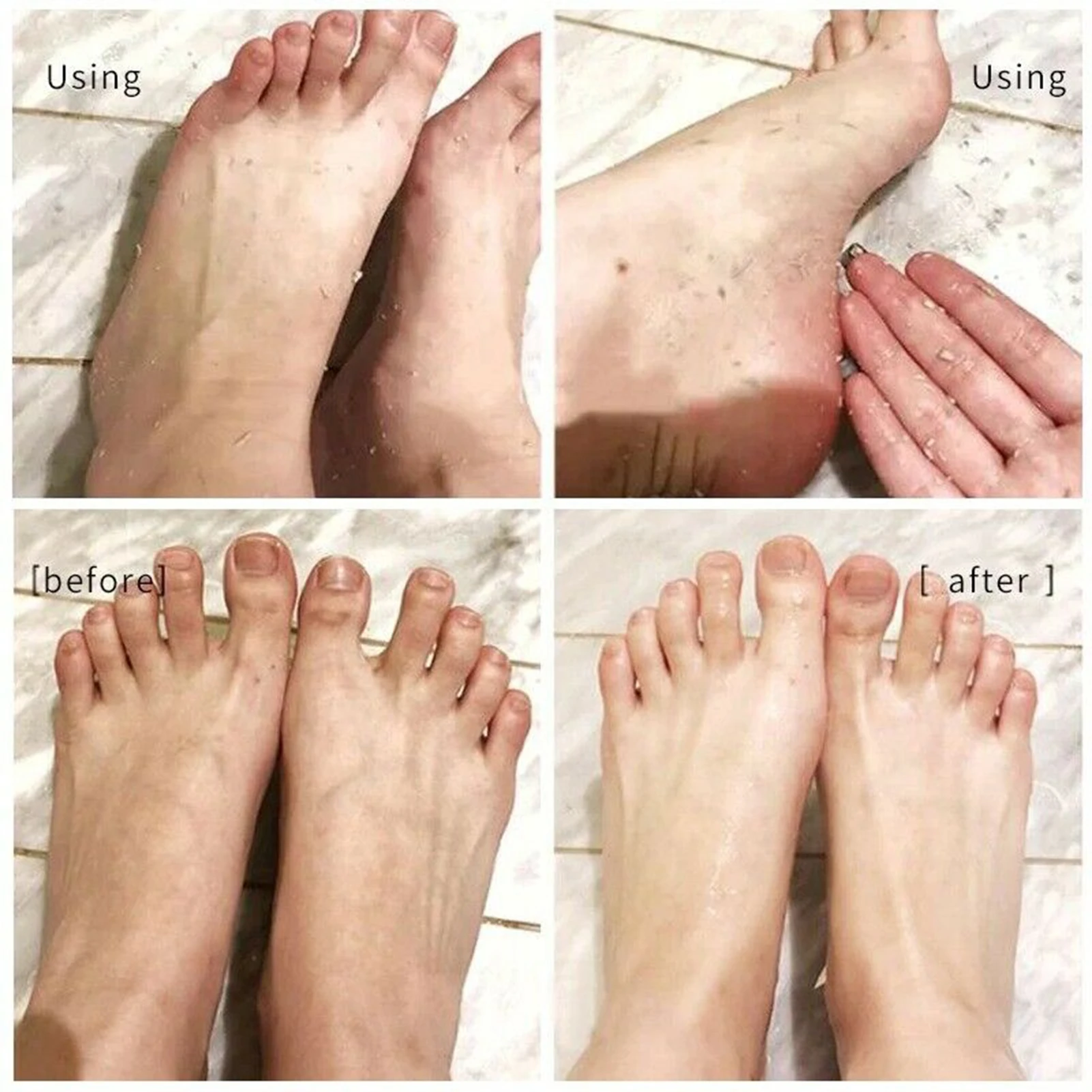 110ML Foot Peeling Spray Dead Skin Exfoliator Softener 110ML Foot Peeling Spray Dead Skin Exfoliator Softener