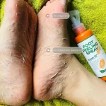 110ML Foot Peeling Spray Dead Skin Exfoliator Softener