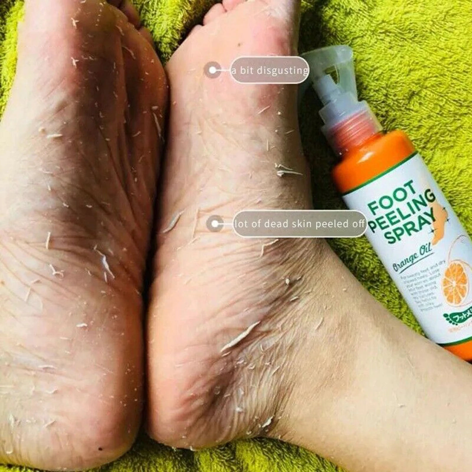 110ML Foot Peeling Spray Dead Skin Exfoliator Softener